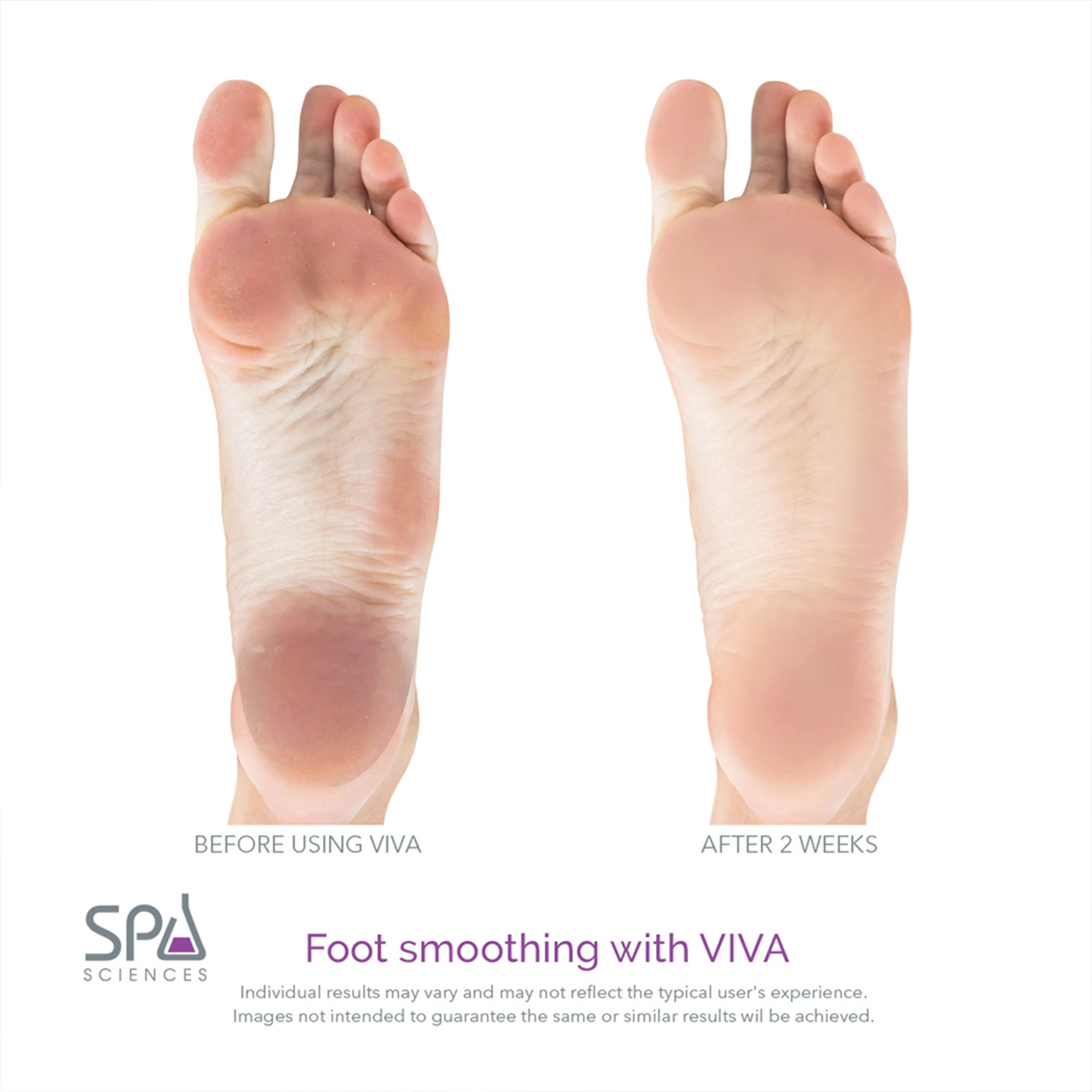 VIVA Bundle - BONUS Course & Fine Pedi Heads